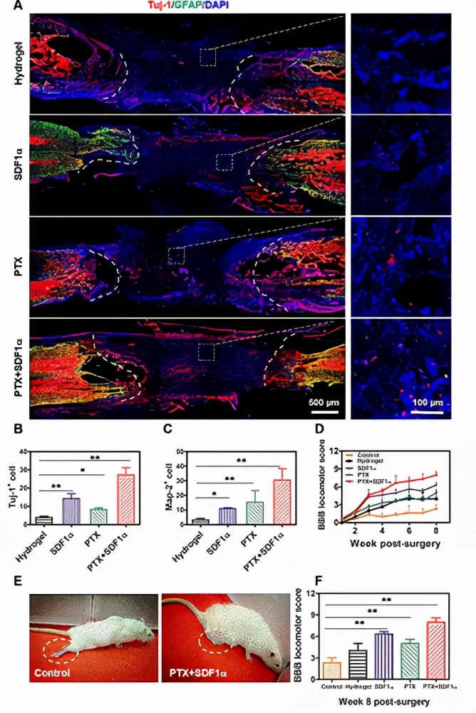 图 7. SDF1α/PTX 时空释放的 Col-FB 纤维水凝胶促进内源性 NSPC 的神经元分化和 SCI 大鼠的运动行为恢复