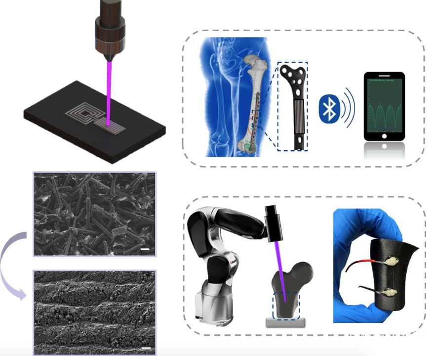 图1 基于激光直写的CFR-PEEK基智能骨科植入物