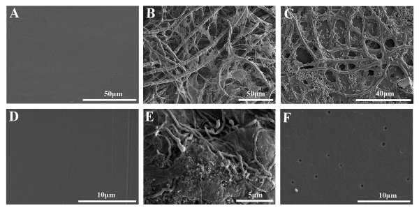 海洋真菌Alternaria alternata FB1对聚乙烯塑料的降解效果 